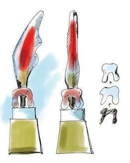 トロフィーデザイン